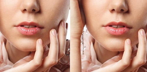 秋燥来袭,嘴唇干得脱皮 秋燥来袭,嘴唇干得脱皮