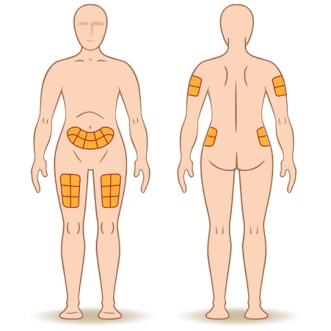 等酒精挥发再注射