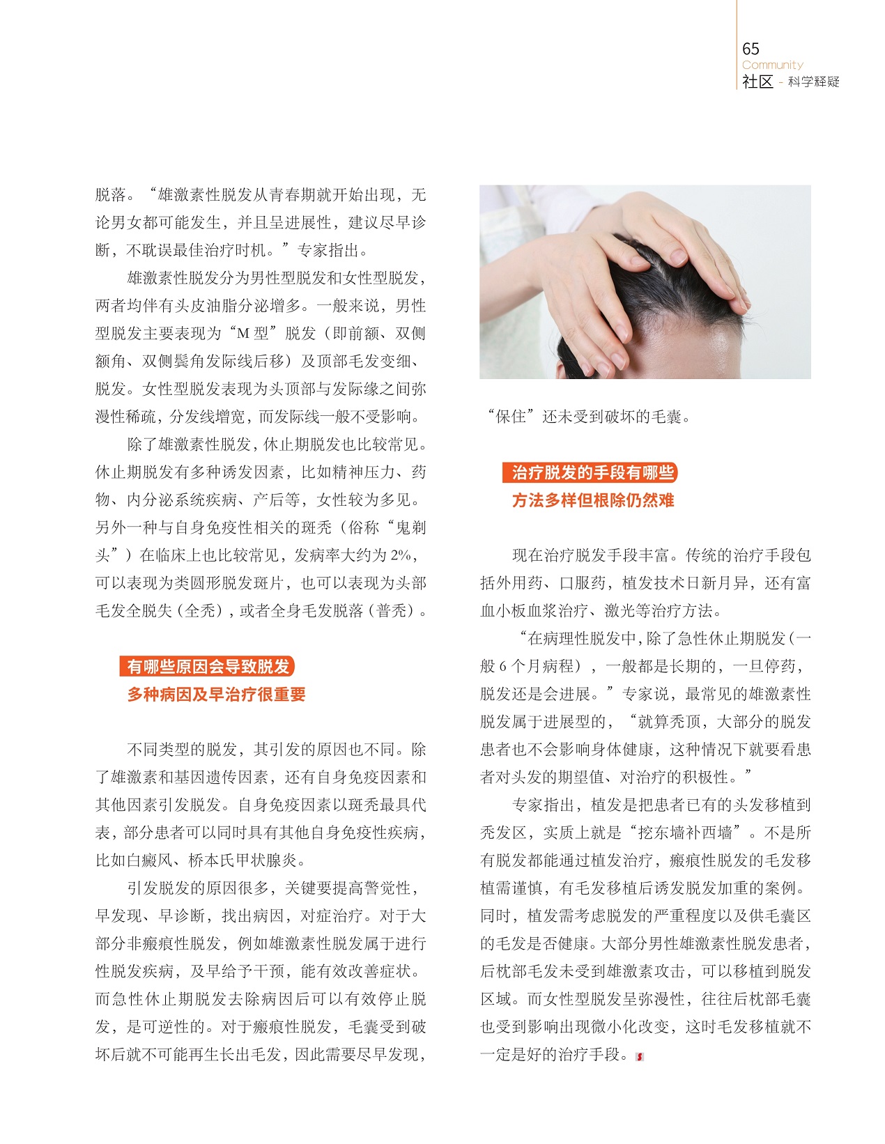 有哪些原因会导致脱发,治疗脱发的手段有哪些