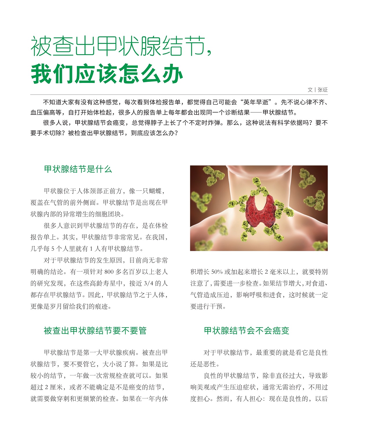 甲状腺结节会癌变,被查出甲状腺结节要不要管