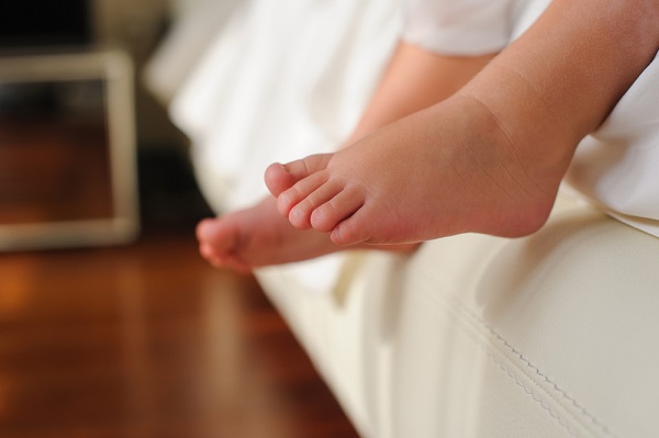 多数平足,无需矫治 多数平足,无需矫治